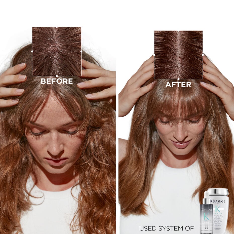 Serum Nuit Antipelliculaire Antidandruff Night Serum